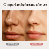 ORYNZA™  Ultrasonic Skin Scrubber